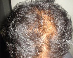 Adivasi Hair Oil - Day 1