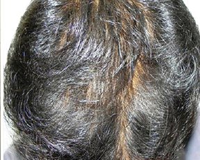 Adivasi Hair Oil - Day 15